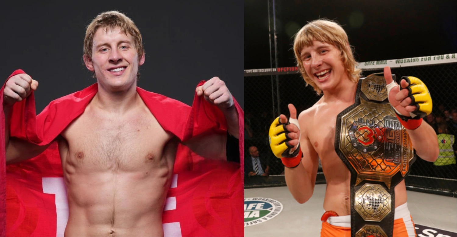 Paddy Pimblett teeth 1